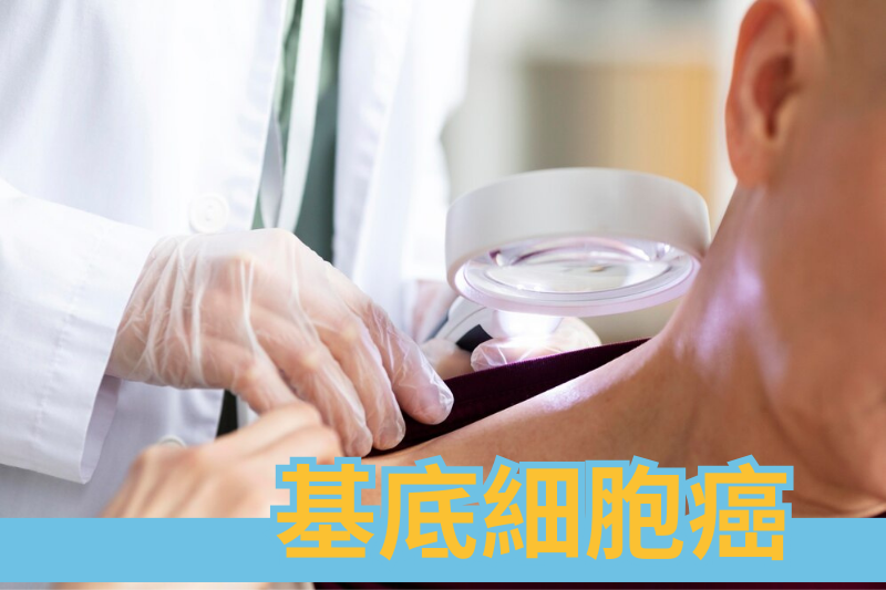 皮膚的警訊：基底細胞癌的深度剖析