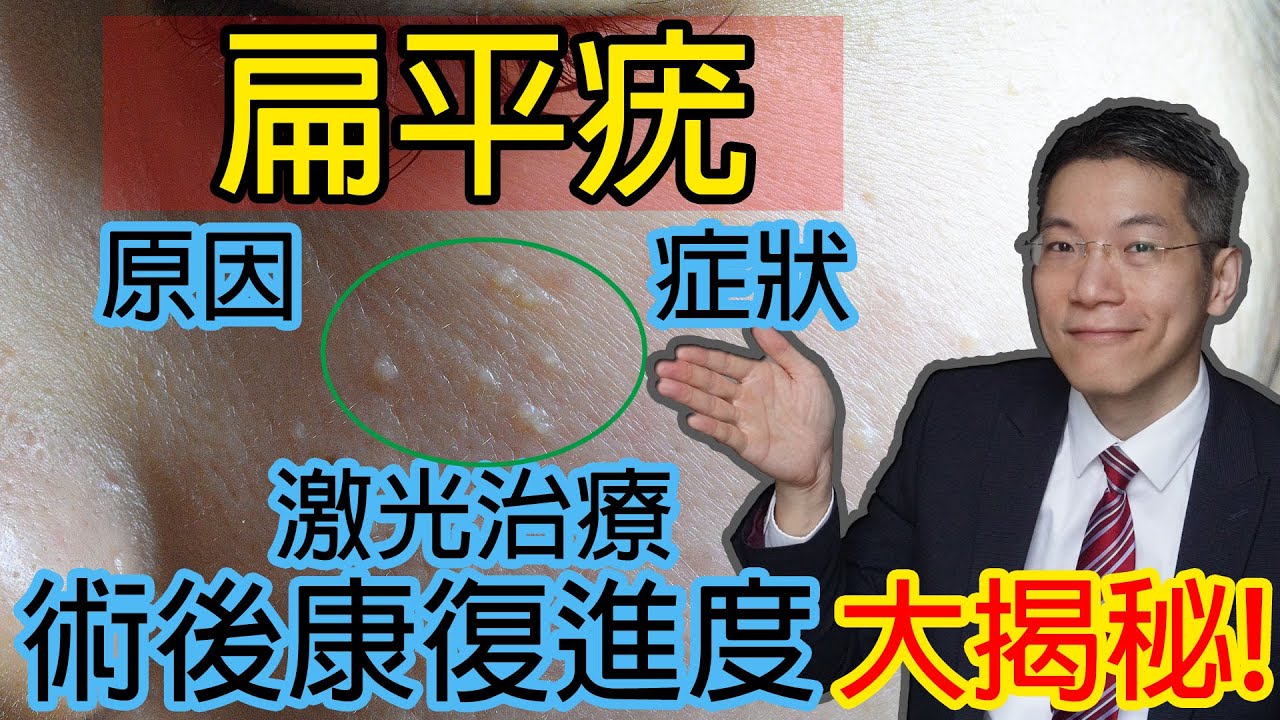 扁平疣激光治療 術後康復進度大揭秘