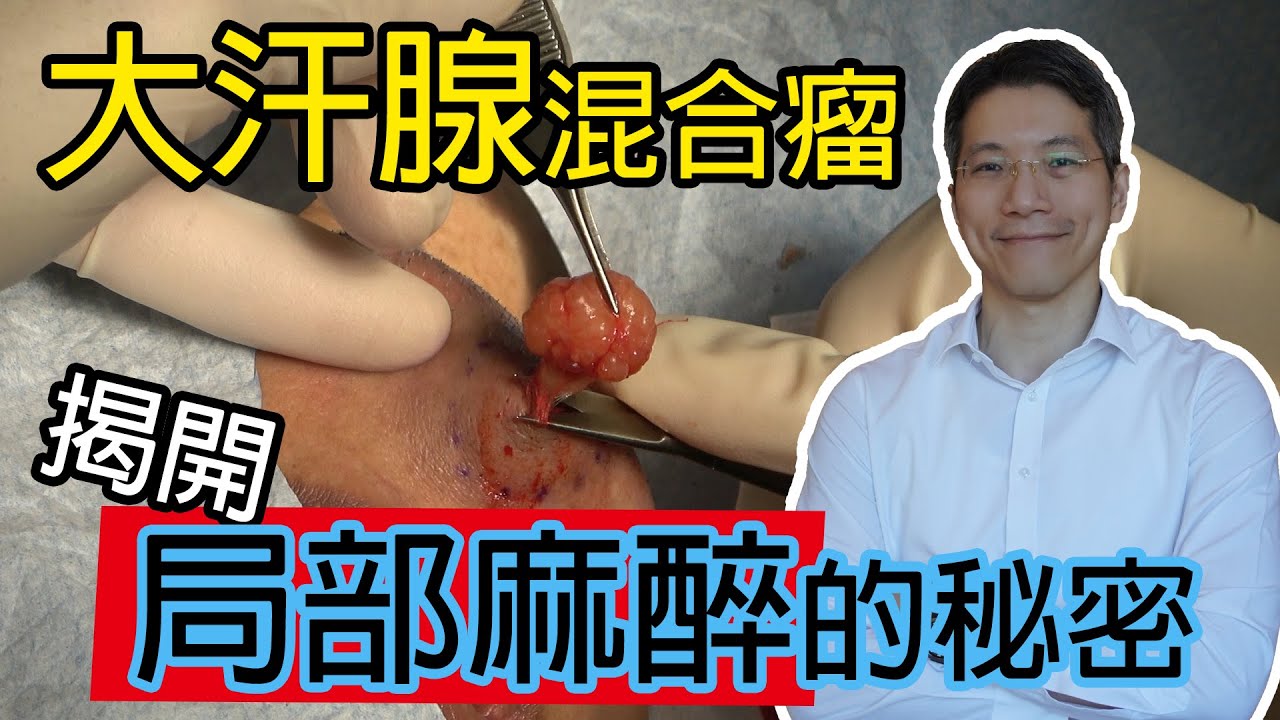 大汗腺混合瘤又是什麽？
