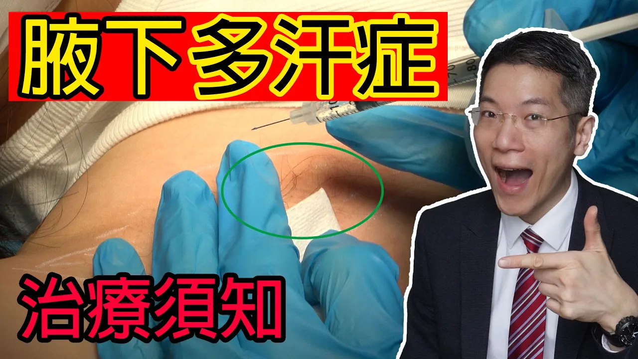 腋下多汗症如何處理