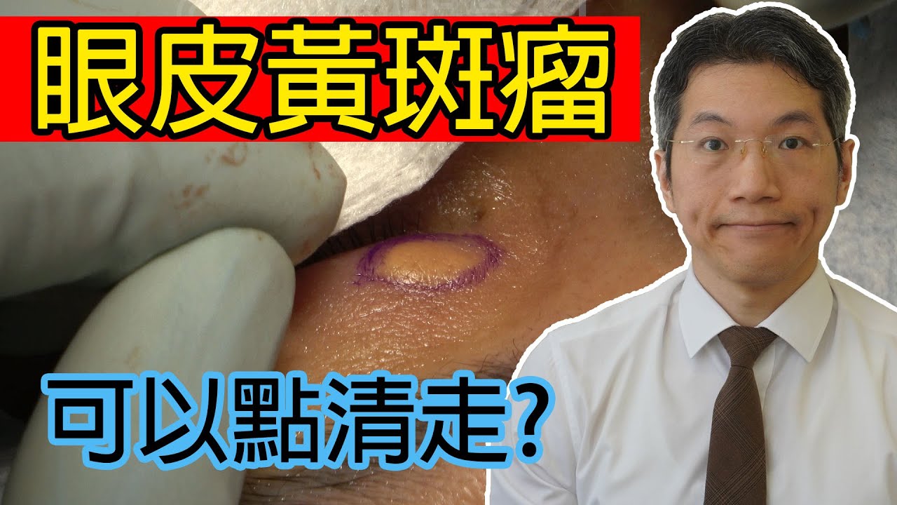 眼皮黃斑瘤