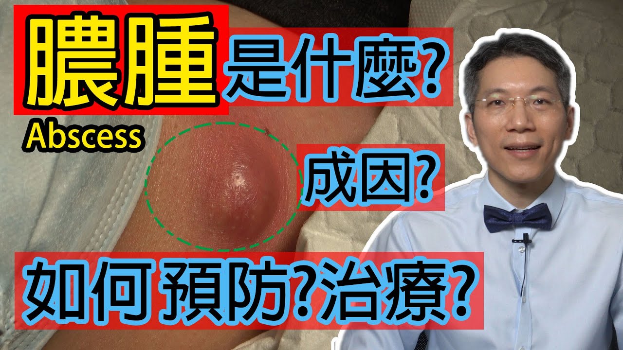 膿腫是什麼