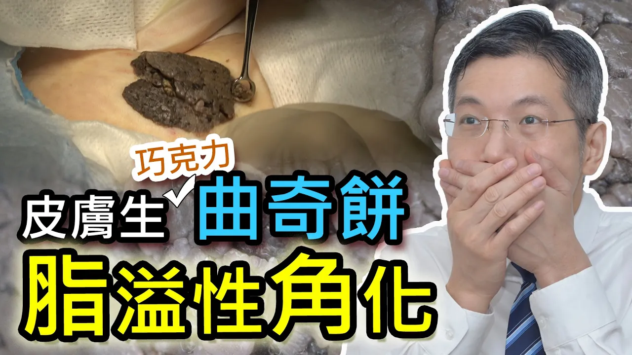皮膚上生了塊朱古力曲奇餅