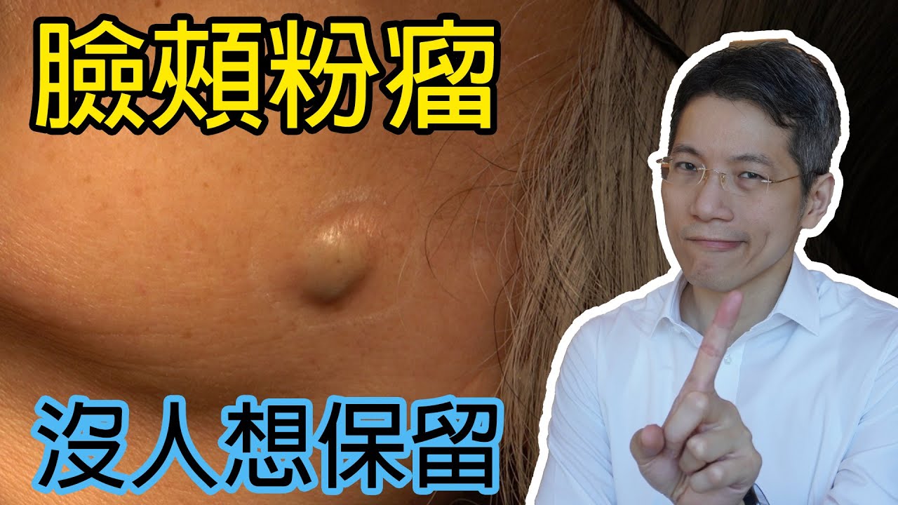 沒有人想保留的臉頰粉瘤