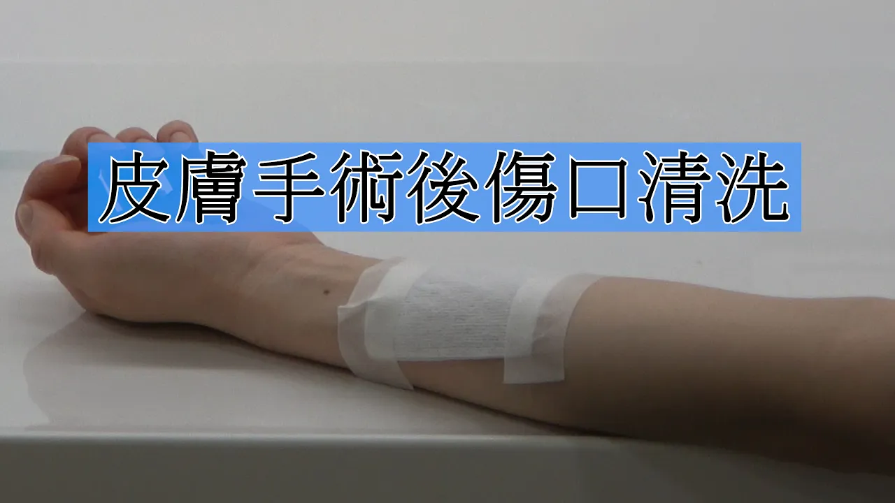 皮膚手術後傷口清洗