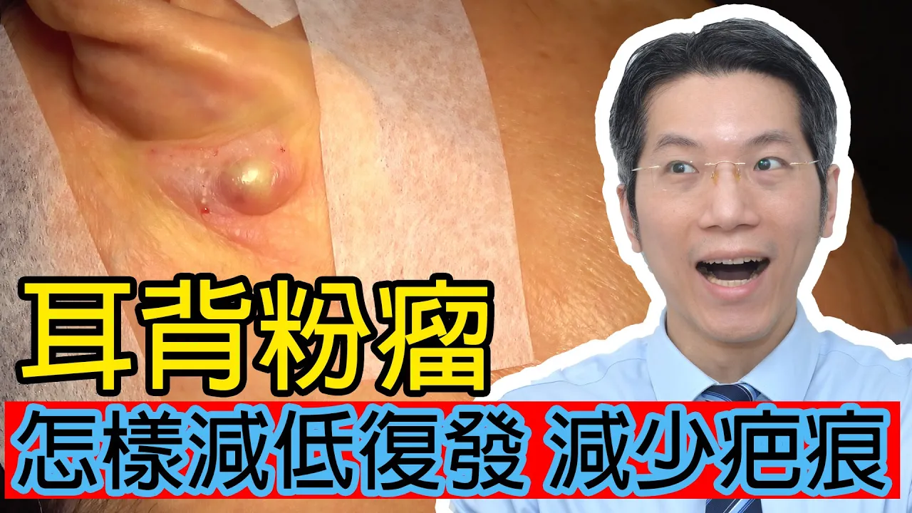 耳背粉瘤