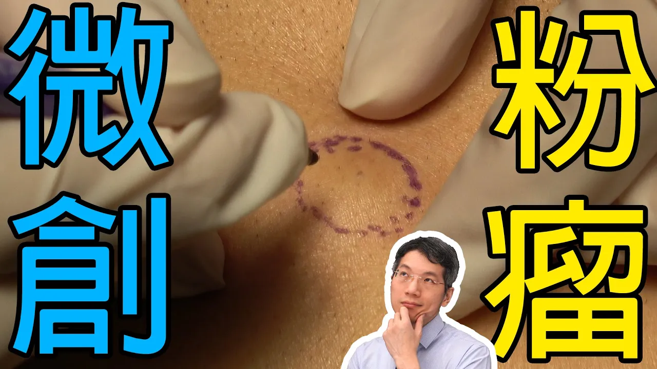 微創粉瘤