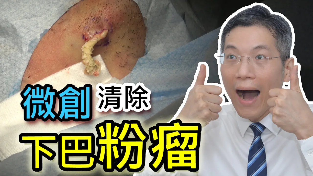 下巴粉瘤
