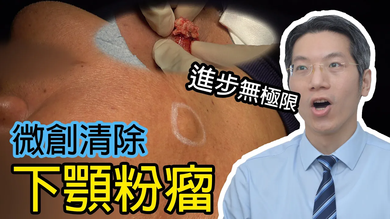 微創清除下颚粉瘤