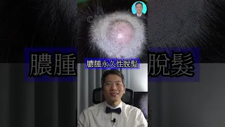 scalp abscess short