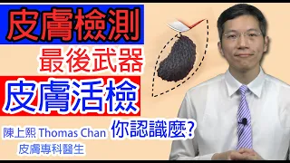 皮膚活檢 甚麼是皮膚活檢？擔心皮膚癌需要做皮膚活檢？