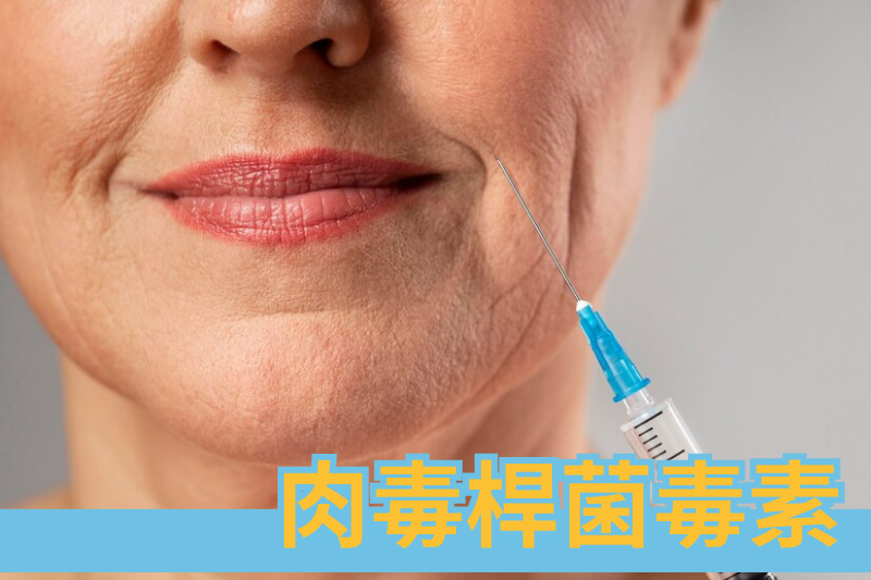 肉毒桿菌毒素：如何重拾青春